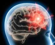 cannabis brain injury